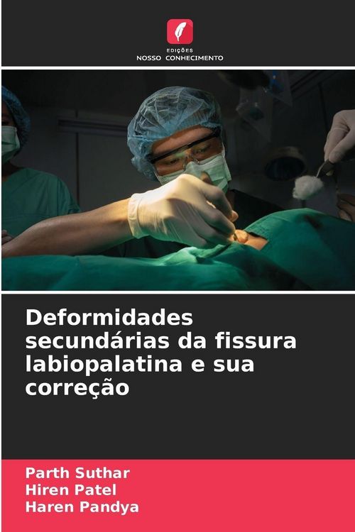 Produktbild: Deformidades secund&aacute;rias da fissura labiopalatina e sua corre&ccedil;&atilde;o