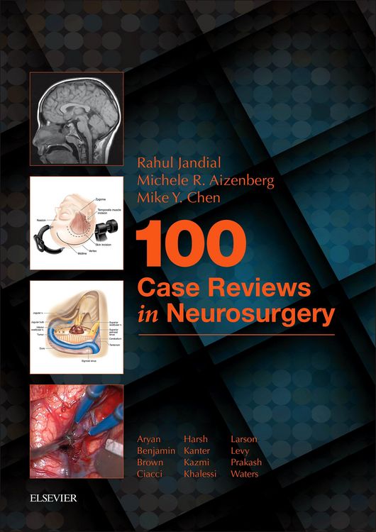 Produktbild: 100 Case Reviews in Neurosurgery E-Book