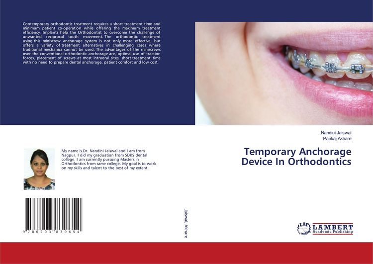 Produktbild: Temporary Anchorage Device In Orthodontics