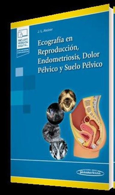 Produktbild: Ecograf&iacute;a en Reproducci&oacute;n, Endometriosis, Dolor P&eacute;lvico y Suelo P&eacute;lvico (+e-book)