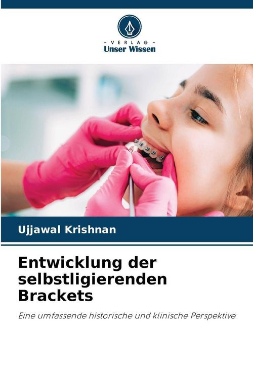 Produktbild: Entwicklung der selbstligierenden Brackets