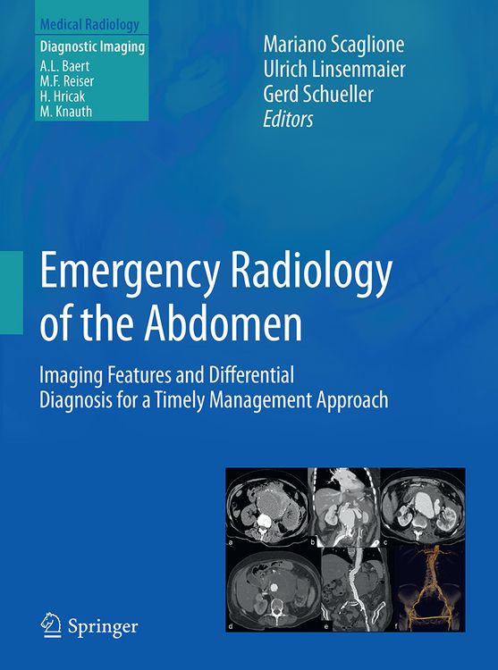 Produktbild: Emergency Radiology of the Abdomen