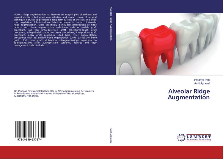Produktbild: Alveolar Ridge Augmentation