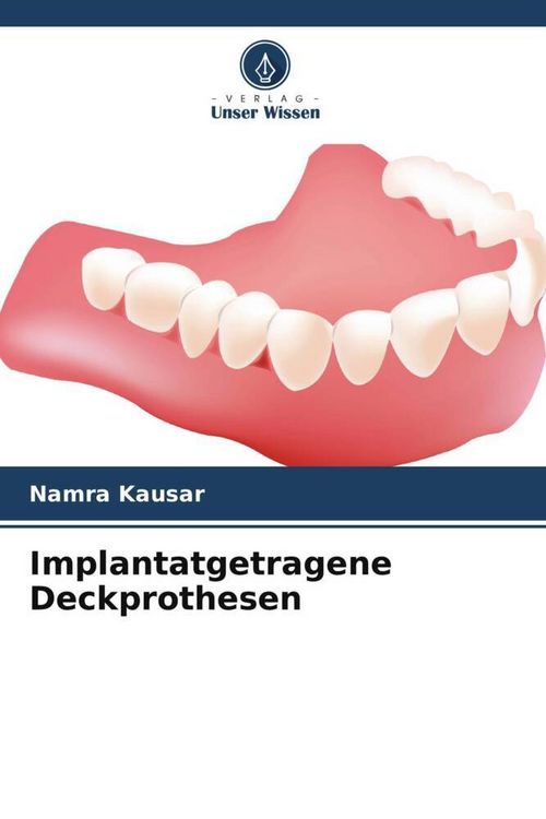 Produktbild: Implantatgetragene Deckprothesen