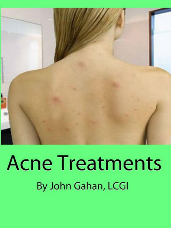 Produktbild: Acne Treatments