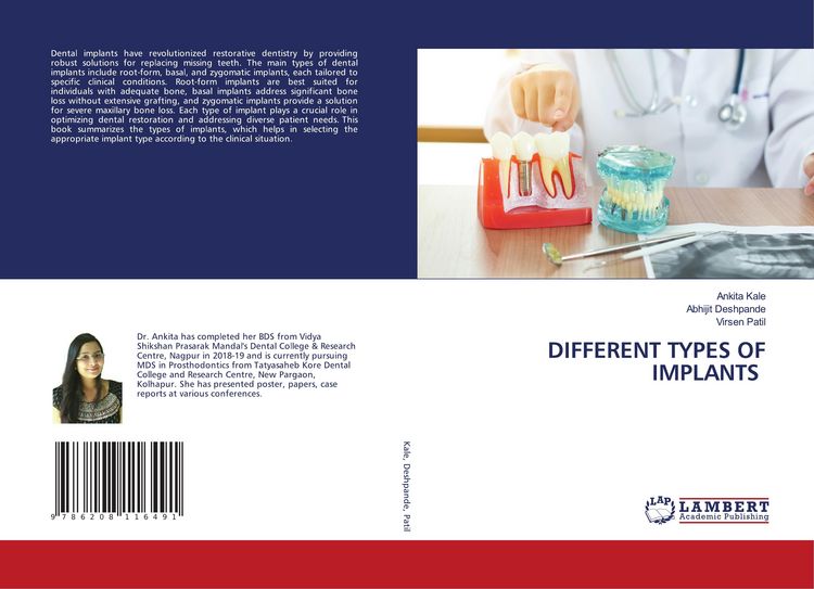 Produktbild: Different Types Of Implants
