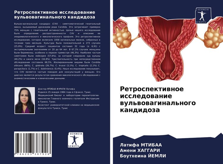 Produktbild: Retrospektiwnoe issledowanie wul'wowaginal'nogo kandidoza