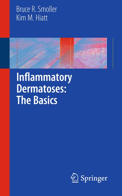 Produktbild: Inflammatory Dermatoses: The Basics