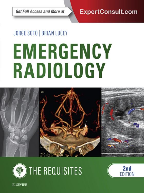 Produktbild: Emergency Radiology: The Requisites E-Book