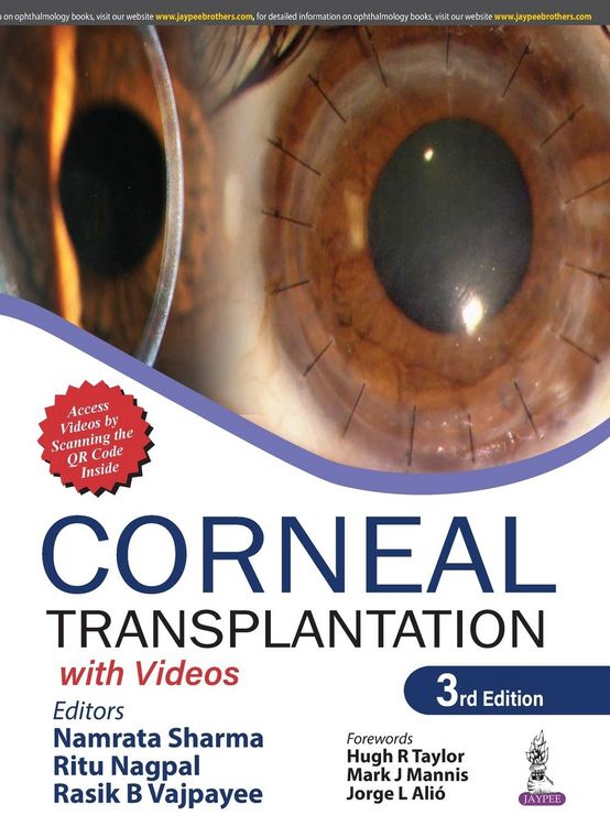 Produktbild: Corneal Transplantation