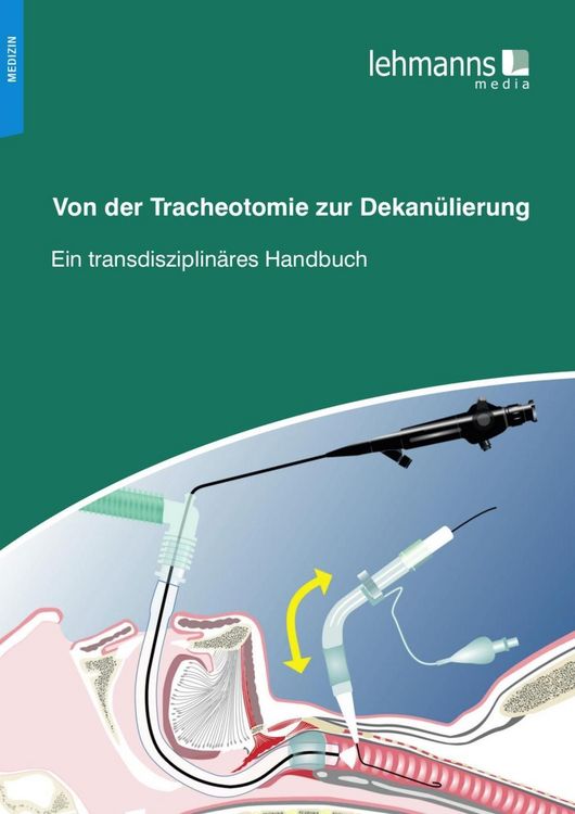 Produktbild: Von der Tracheotomie zur Dekan&uuml;lierung