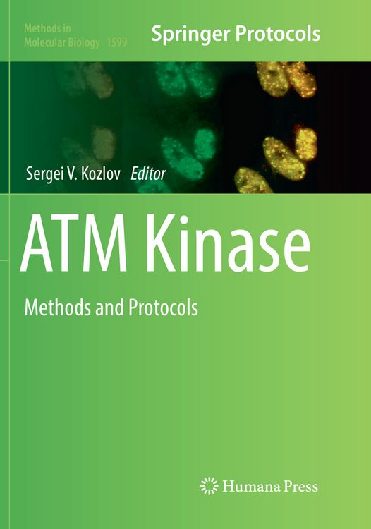 Produktbild: ATM Kinase