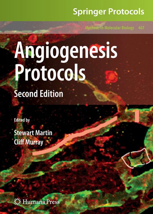 Produktbild: Angiogenesis Protocols