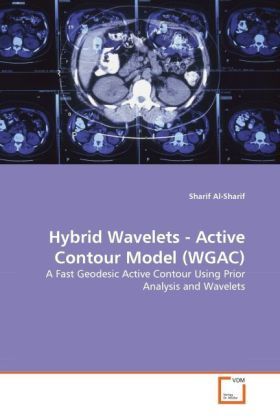 Produktbild: Al-Sharif, S: Hybrid Wavelets - Active Contour Model (WGAC)