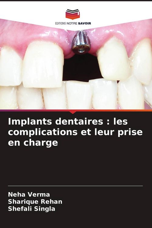 Produktbild: Implants dentaires : les complications et leur prise en charge