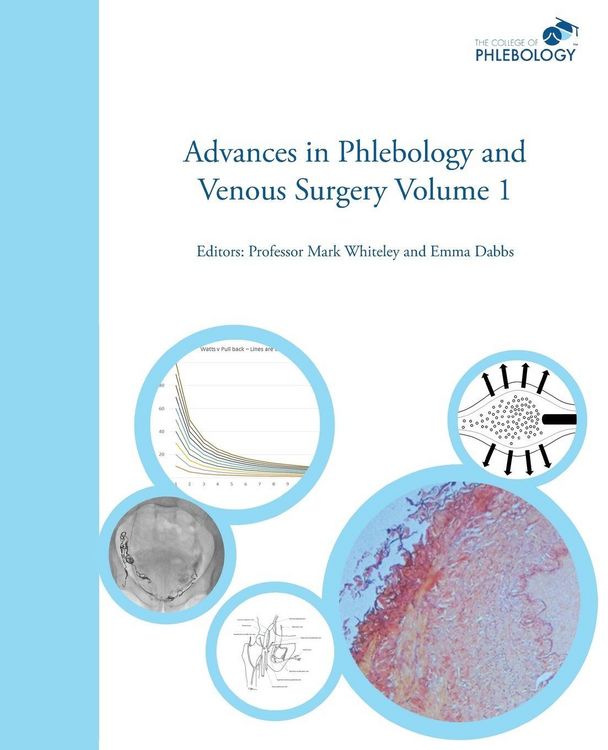 Produktbild: Advances in Phlebology and Venous Surgery Volume 1