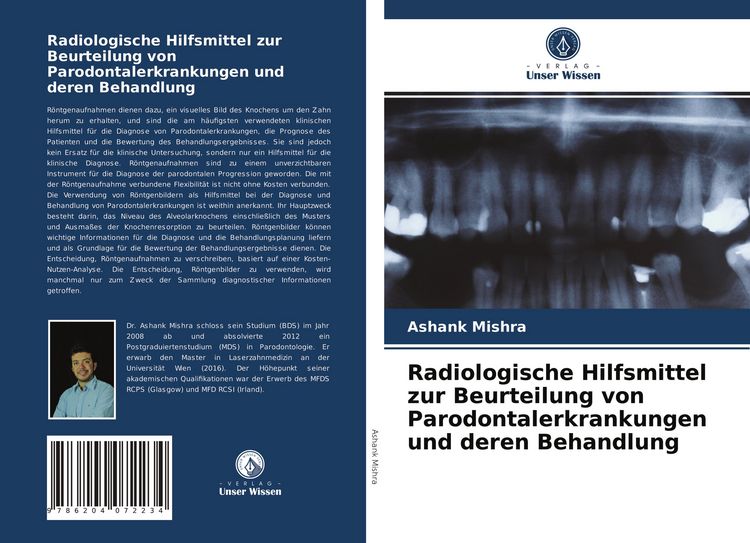 Produktbild: Radiologische Hilfsmittel zur Beurteilung von Parodontalerkrankungen und deren Behandlung