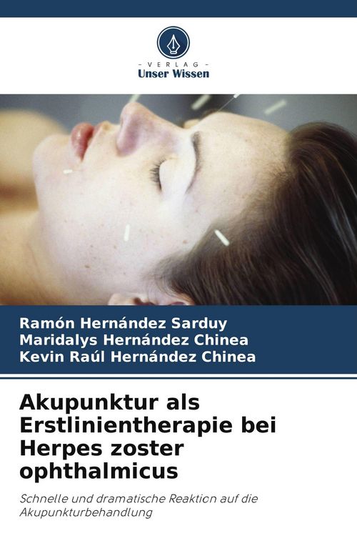 Produktbild: Akupunktur als Erstlinientherapie bei Herpes zoster ophthalmicus