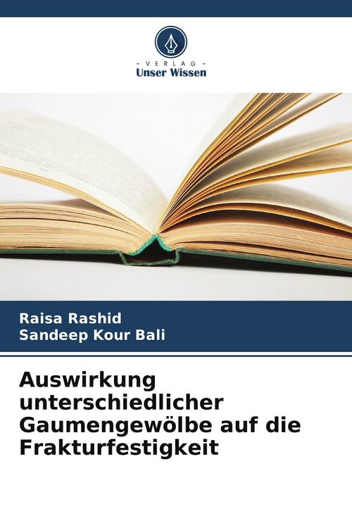 Produktbild: Auswirkung unterschiedlicher Gaumengew&ouml;lbe auf die Frakturfestigkeit