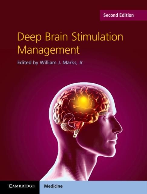 Produktbild: Deep Brain Stimulation Management