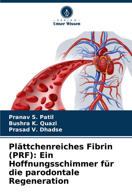 Produktbild: Pl&auml;ttchenreiches Fibrin (PRF): Ein Hoffnungsschimmer f&uuml;r die parodontale Regeneration