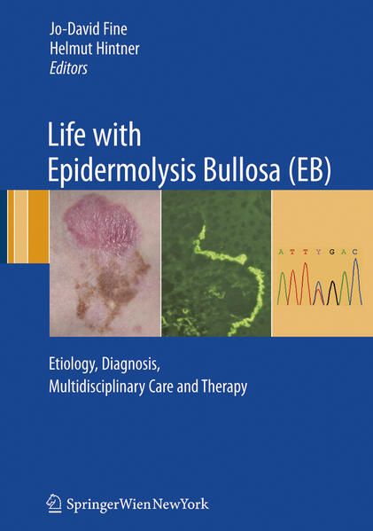 Produktbild: Life with Epidermolysis Bullosa (EB)