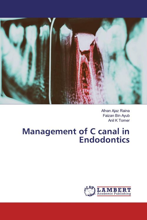 Produktbild: Management of C canal in Endodontics