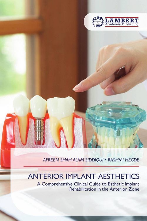 Produktbild: Anterior Implant Aesthetics