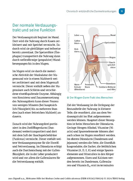 Produktbild: Wirksame Hilfe bei Morbus Crohn und Colitis ulcerosa