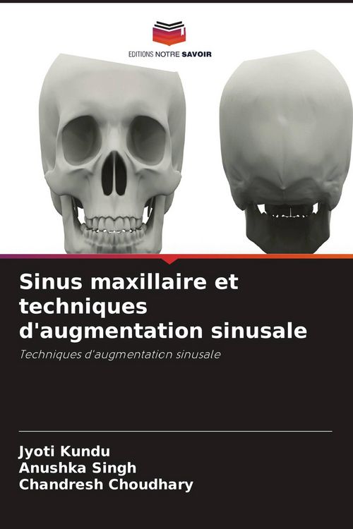 Produktbild: Sinus maxillaire et techniques d'augmentation sinusale