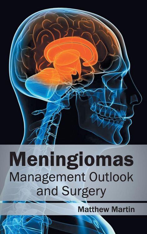 Produktbild: Meningiomas