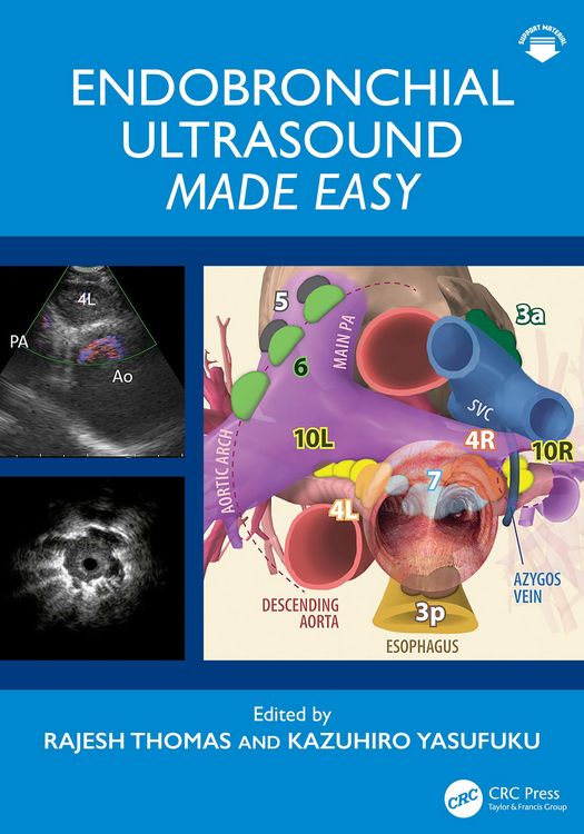 Produktbild: Endobronchial Ultrasound Made Easy