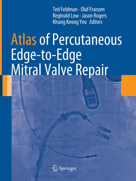Produktbild: Atlas of Percutaneous Edge-to-Edge Mitral Valve Repair