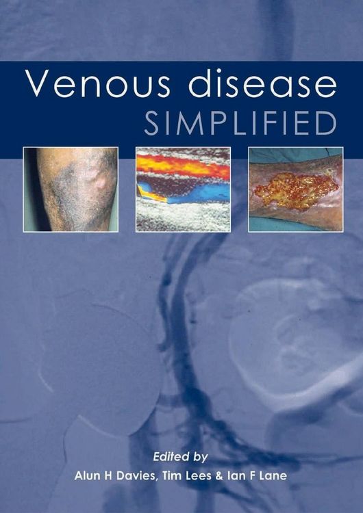 Produktbild: Venous Disease Simplified