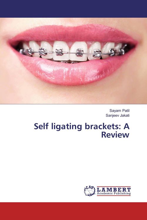 Produktbild: Self ligating brackets: A Review