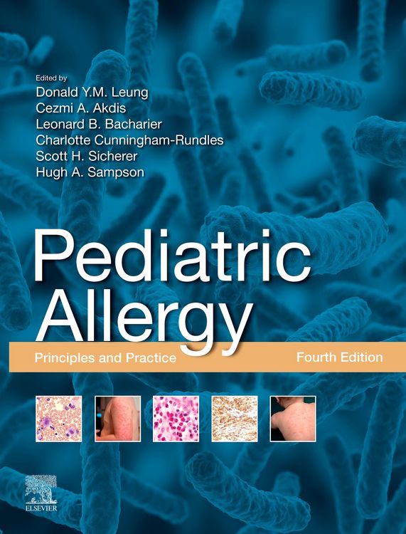 Produktbild: Pediatric Allergy,E-Book