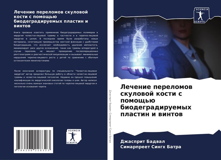 Produktbild: Lechenie perelomow skulowoj kosti s pomosch'&uuml; biodegradiruemyh plastin i wintow