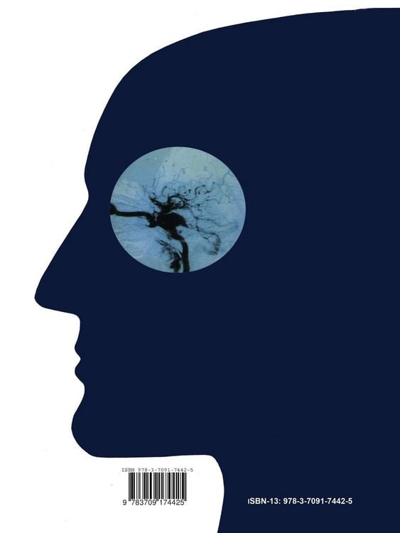 Produktbild: Anatomy and Surgery of the Cavernous Sinus