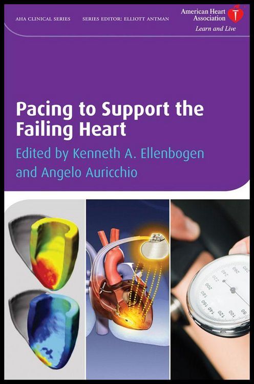 Produktbild: Pacing to Support the Failing Heart