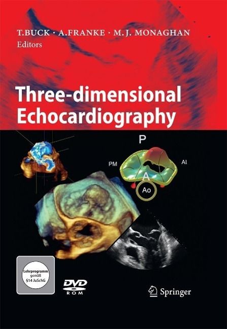 Produktbild: Three-dimensional Echocardiography