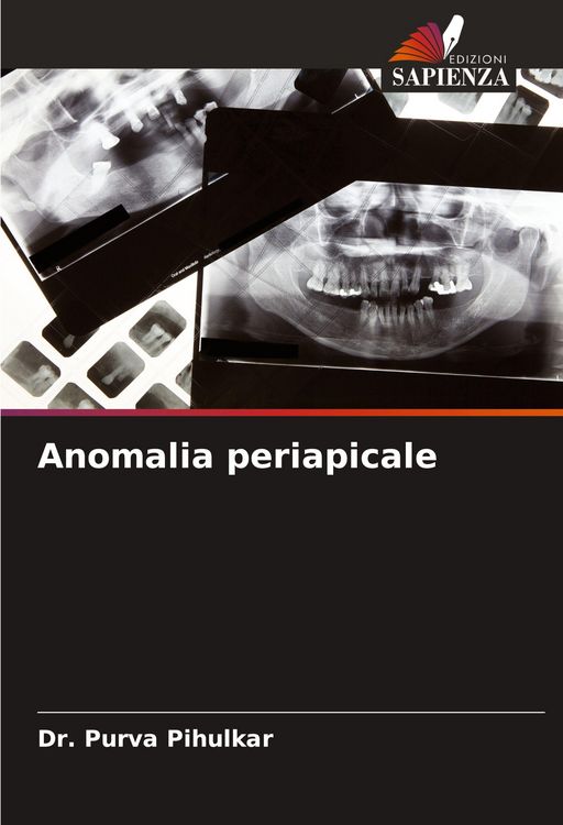 Produktbild: Anomalia periapicale