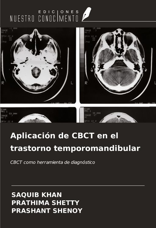 Produktbild: Aplicaci&oacute;n de CBCT en el trastorno temporomandibular