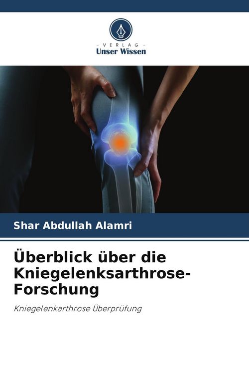 Produktbild: &Uuml;berblick &uuml;ber die Kniegelenksarthrose-Forschung
