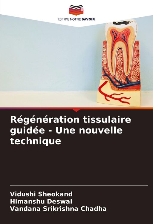 Produktbild: R&eacute;g&eacute;n&eacute;ration tissulaire guid&eacute;e - Une nouvelle technique
