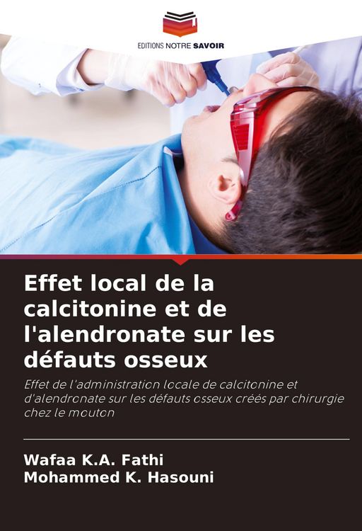 Produktbild: Effet local de la calcitonine et de l'alendronate sur les d&eacute;fauts osseux