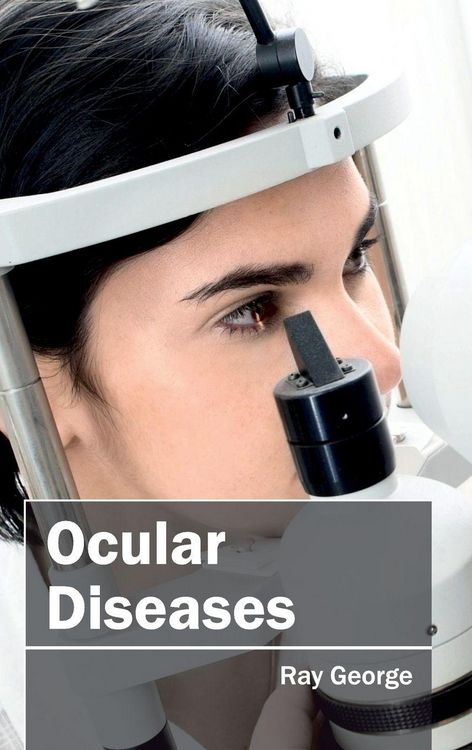 Produktbild: Ocular Diseases