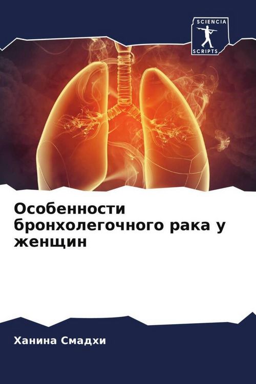 Produktbild: Osobennosti bronholegochnogo raka u zhenschin