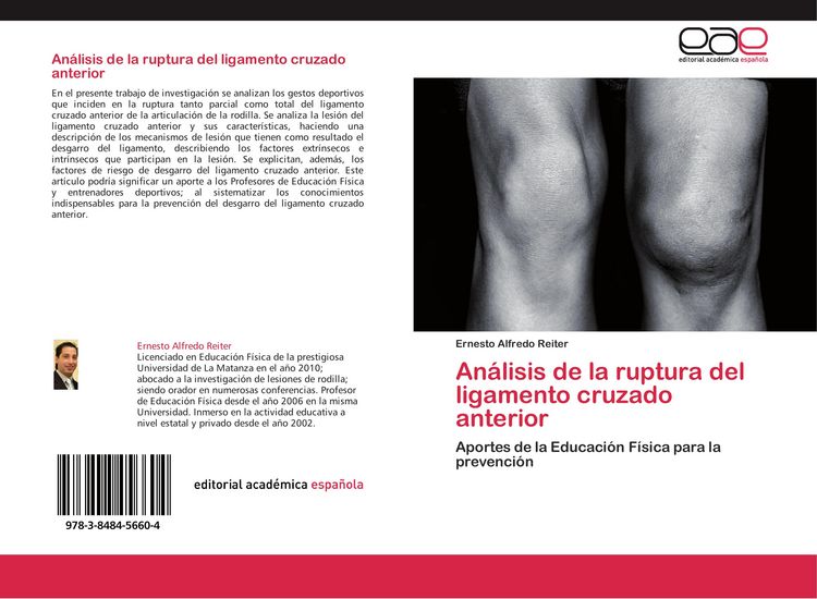 Produktbild: An&aacute;lisis de la ruptura del ligamento cruzado anterior