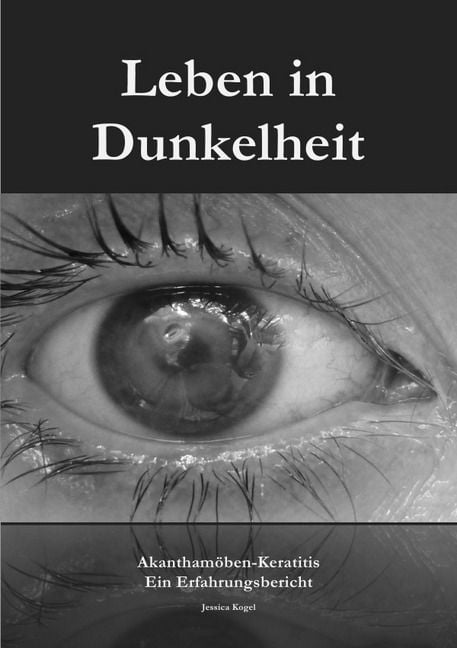 Produktbild: Leben in Dunkelheit - Akantham&ouml;ben-Keratitis