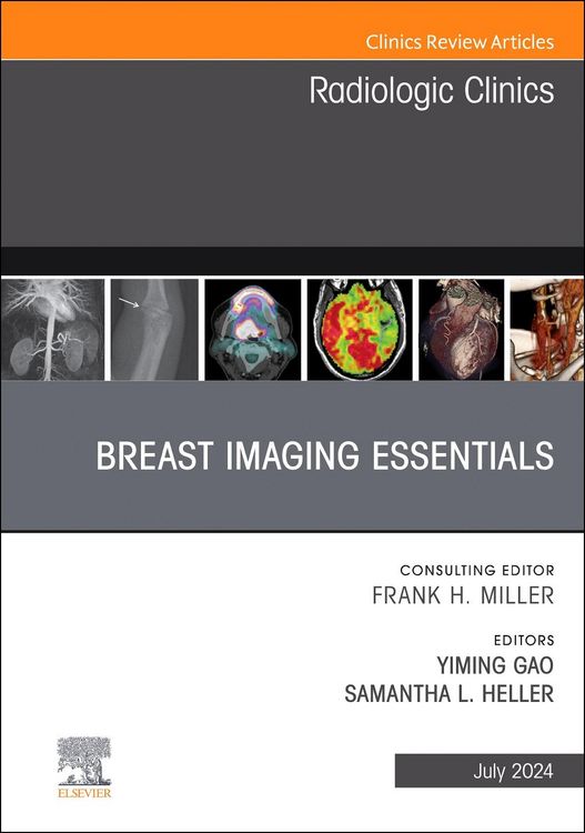 Produktbild: Breast Imaging Essentials, An Issue of Radiologic Clinics of